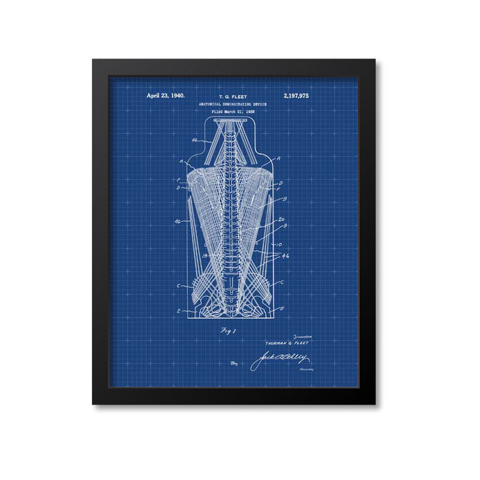 Anatomical Spine Skeleton Print